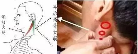 記住“三條筋”，能治很多??！(圖1)